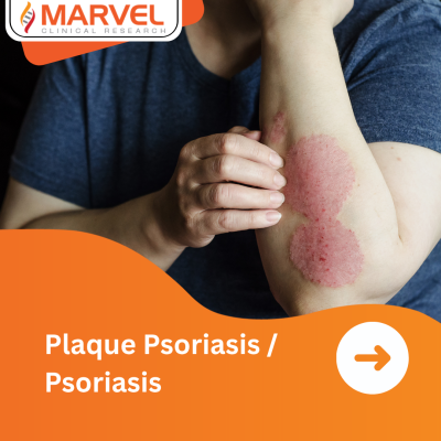 Plaque Psoriasis